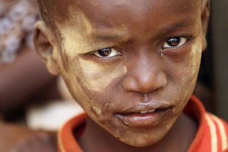 1,4 milyon uşaq acından ölə bilər